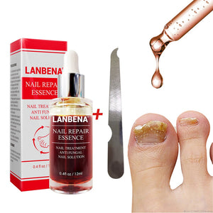 LANBENA Nail Repair Liquid Treatment with Nail File.  Anti Fungal  and Removal of Nail Onychomycosis Toe Nourishing Brighten Nails TSLM1